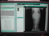 デジタルレントゲン画像診断システム